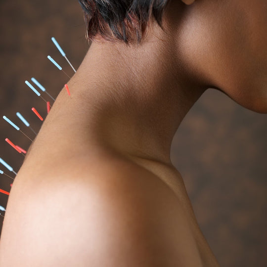 Natural Beauty Benefits Of Acupuncture