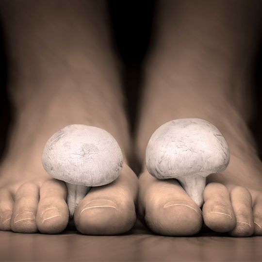 How To Naturally Treat Fungus On Your Toes: 3 Quick And Easy Tips