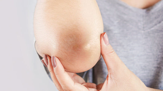 Do You Have Dark Elbows and Knees? We Have The Remedy