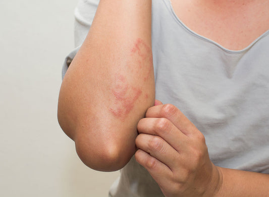 10 Signs You May Be Gluten Intolerant