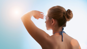 Naturally Heal and Treat Sun Damage: Your Ultimate Guide