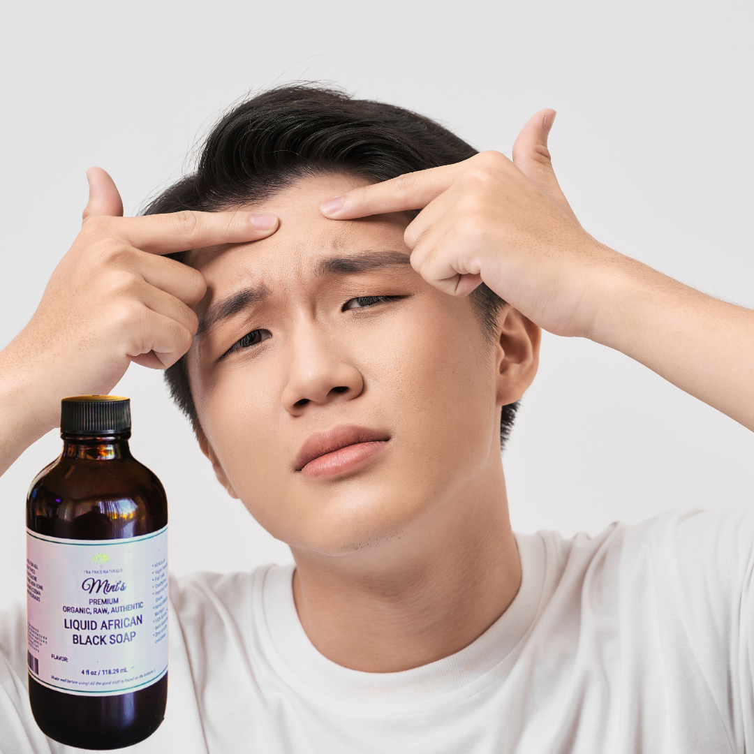 Fra Fra's Mini's | Premium EXTREME Healing Acne Blend Liquid Black Soa ...