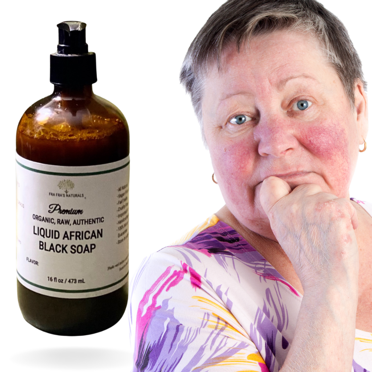 Fra Fra's Naturals | Premium Extreme Healing Rosacea Liquid African Black Soap