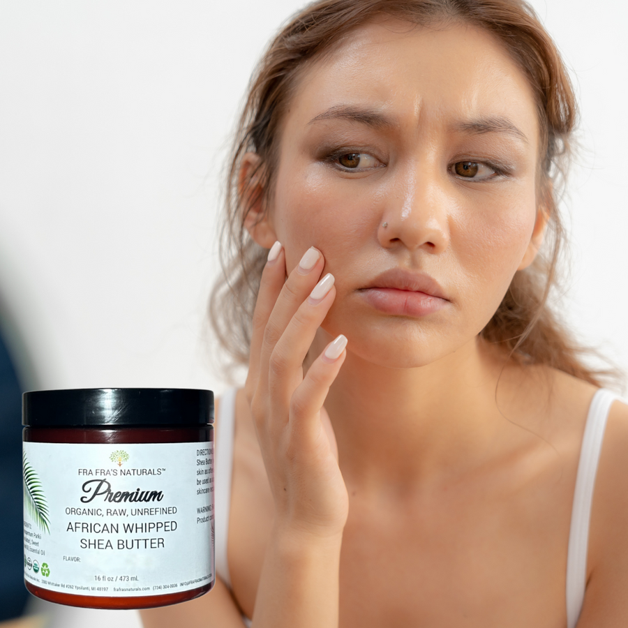 Fra Fra's Naturals | Premium EXTREME Healing Acne Whipped Shea Butter Blend