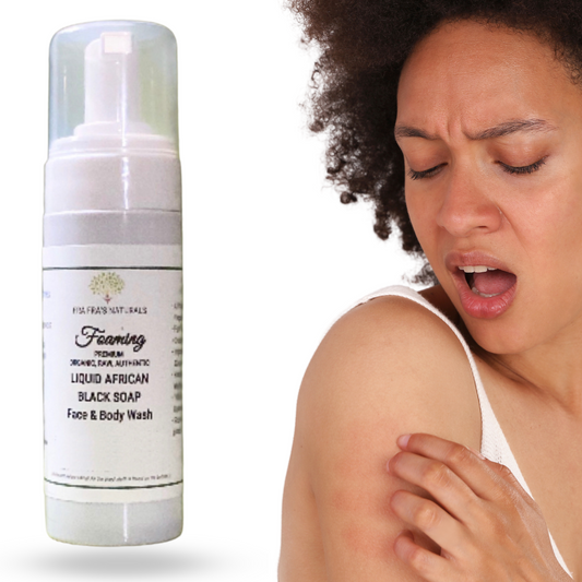 Fra Fra's Naturals | Premium Anti-Itch Foaming African Black Soap Face and Body Wash