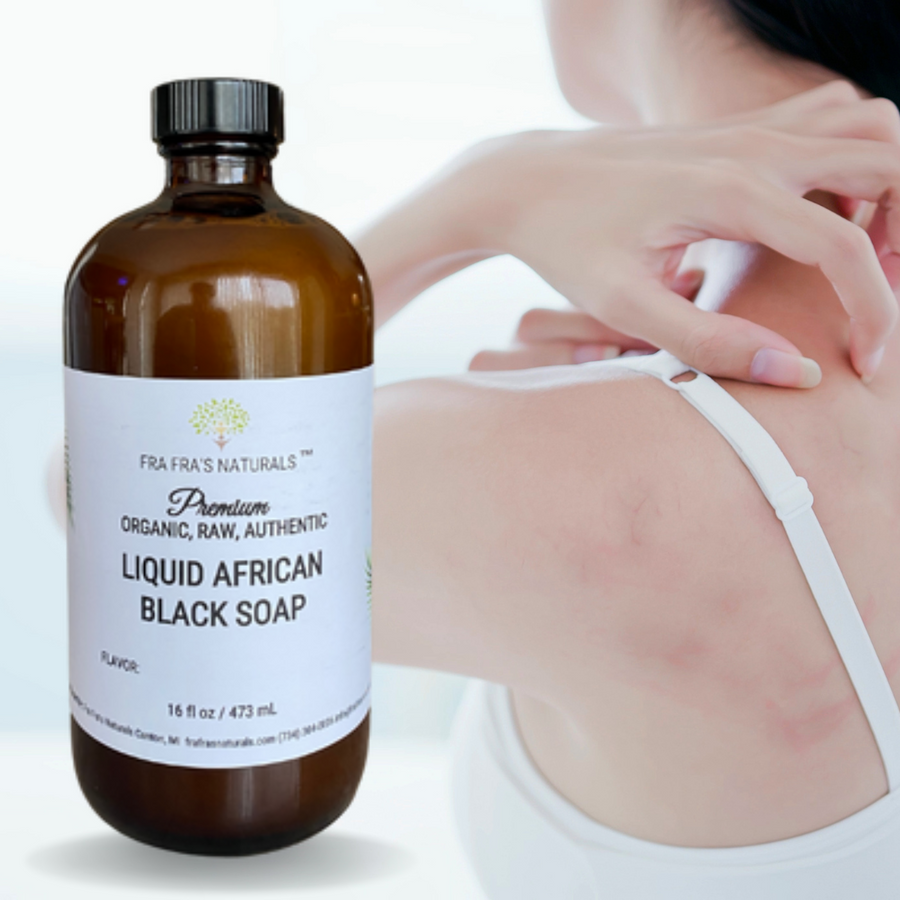 Fra Fra's Naturals | Premium Healing Eczema Blend Liquid Black Soap