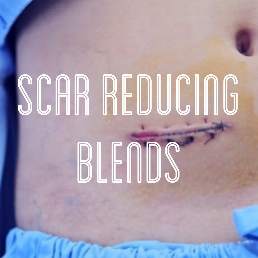 Fra Fra's Naturals | Premium Healing Scar Reducing African Black Soap Blends