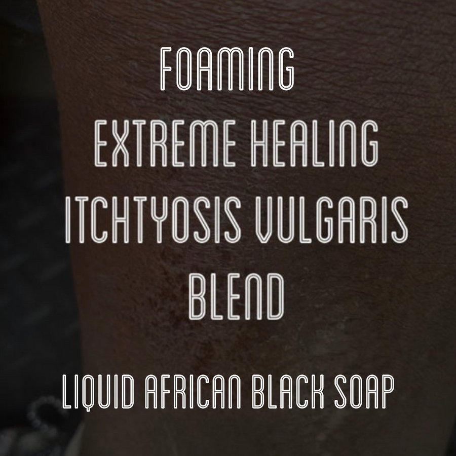 Fra Fra's Naturals | Premium Extreme Healing Itchtyosis Vulgaris Foaming African Black Soap Face and Body Wash