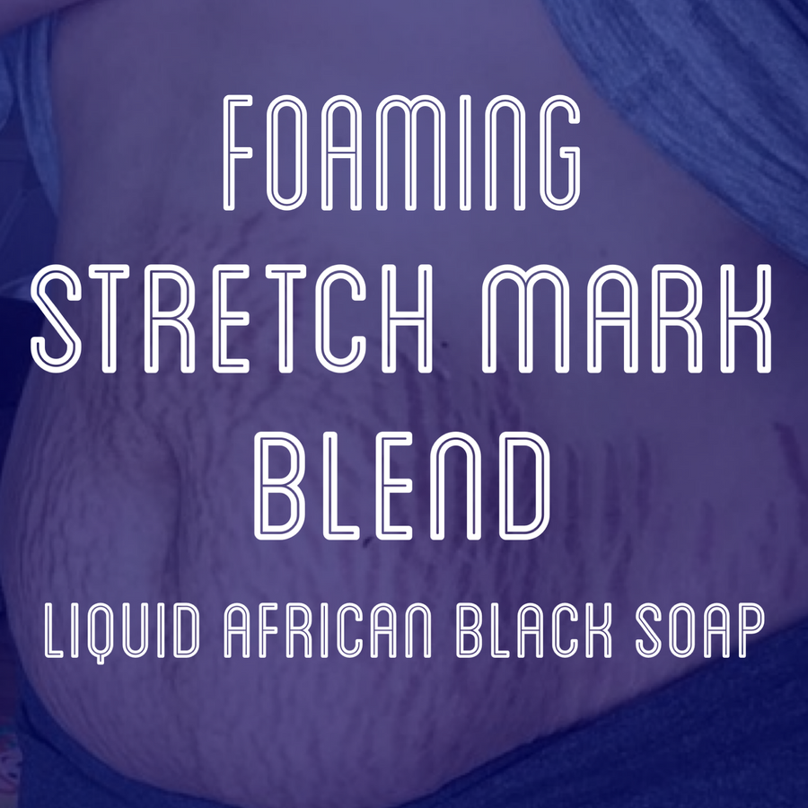 Fra Fra's Naturals | Premium Stretch Mark Foaming African Black Soap Face and Body Wash