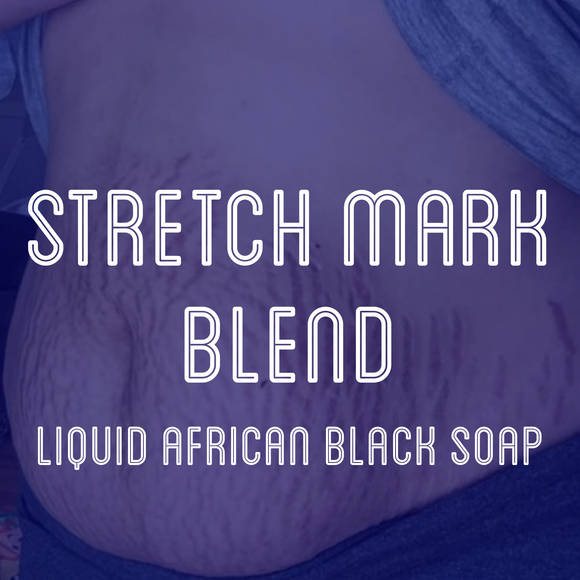 Fra Fra's Naturals | Premium Stretch Mark Liquid African Black Soap Blend