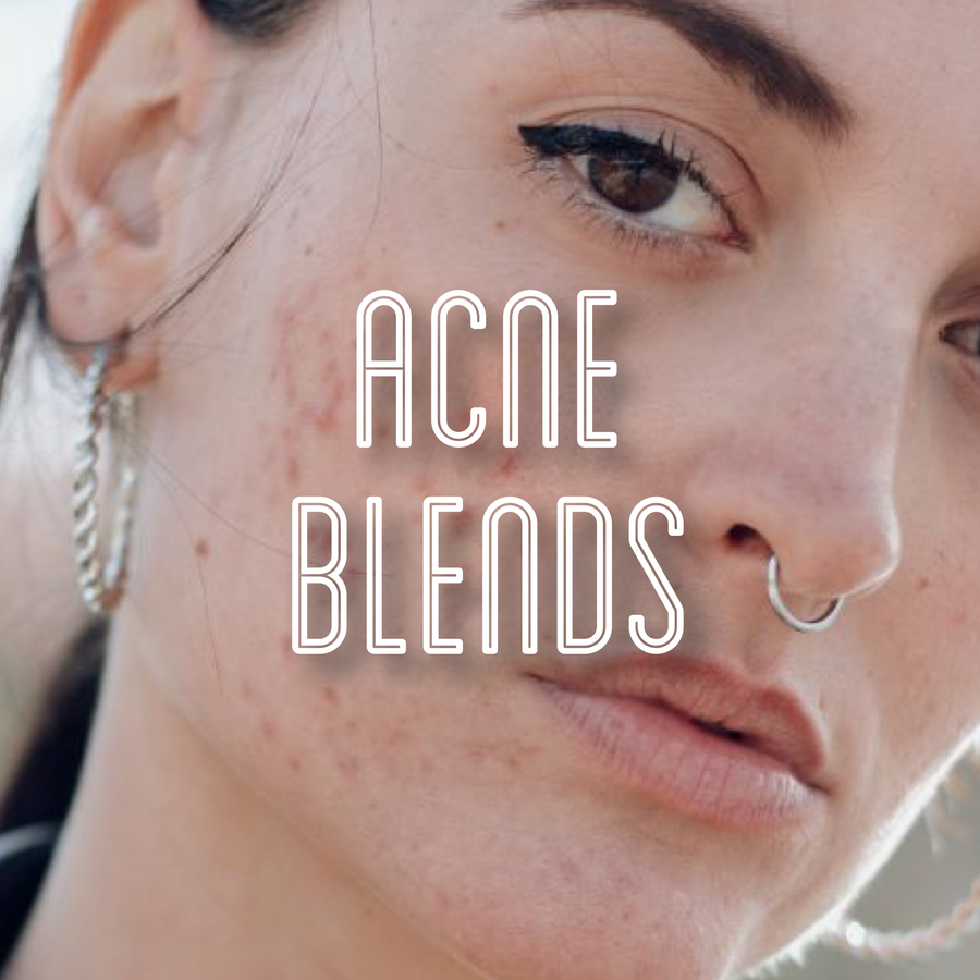 Fra Fra's Naturals | Premium Healing Acne Blends