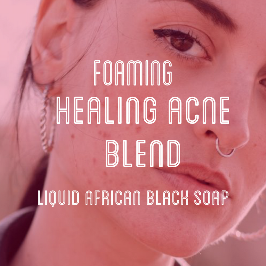 Fra Fra's Naturals | Premium Healing Acne Foaming African Black Soap Face and Body Wash
