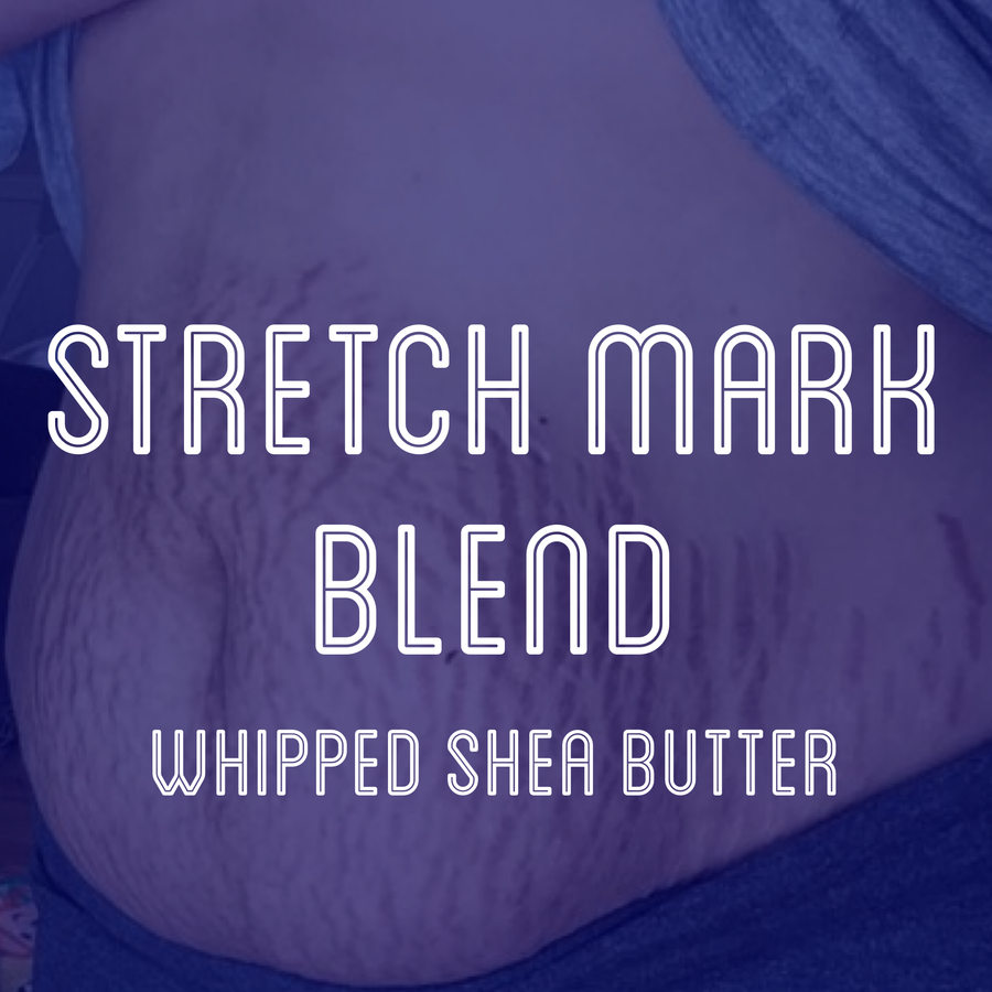 Fra Fra's Naturals | Premium Stretch Mark Shea Butter Blend
