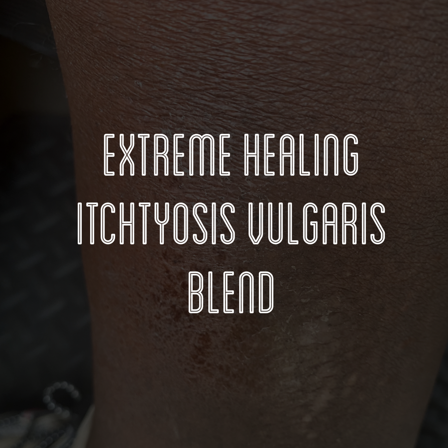 Fra Fra's Naturals | Premium Extreme Healing Itchtyosis Vulgaris Blends