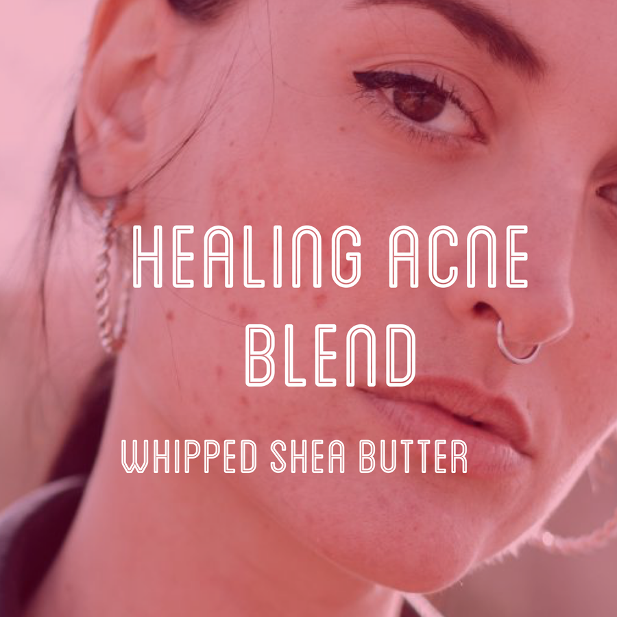 Fra Fra's Naturals | Premium Healing Acne Blend Shea Butter