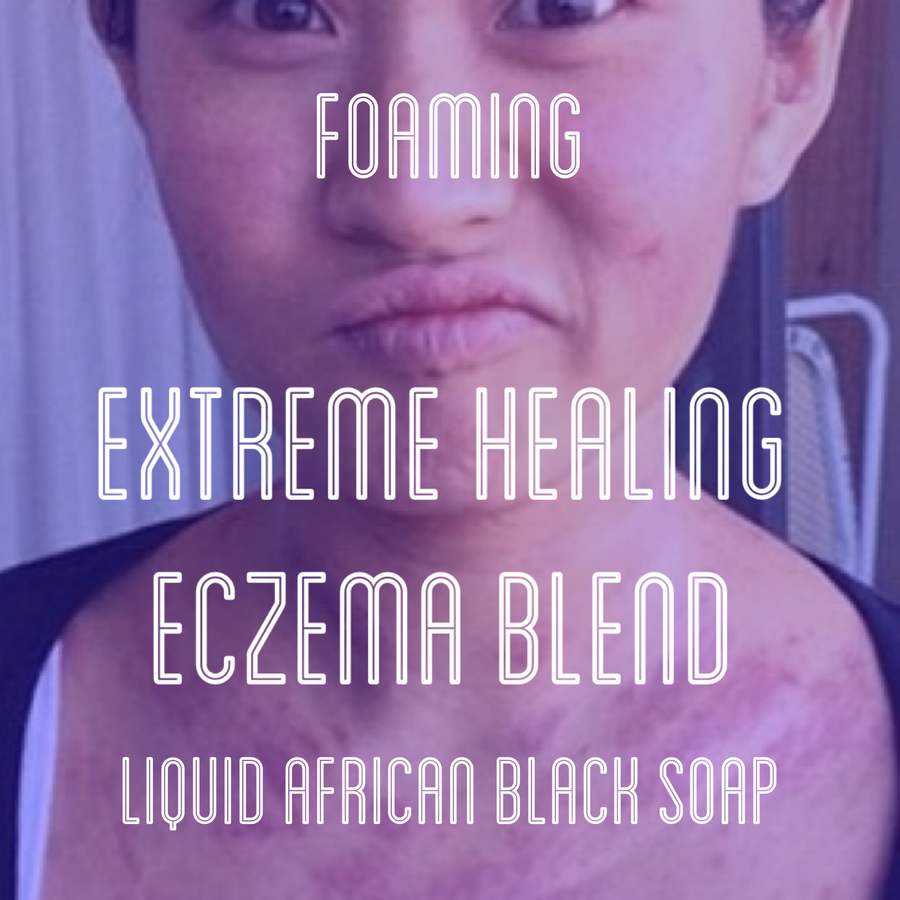 Fra Fra's Naturals | Premium EXTREME Healing Eczema Foaming African Black Soap Face and Body Wash