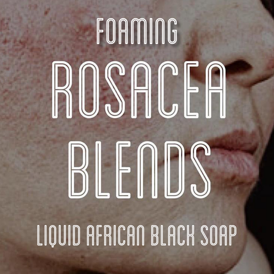 Fra Fra's Naturals | Premium Healing Rosacea Foaming African Black Soap Face and Body Wash