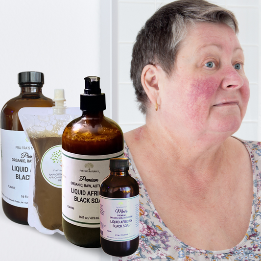 Fra Fra's Naturals | Premium Healing Liquid Black Soap Rosacea Blends