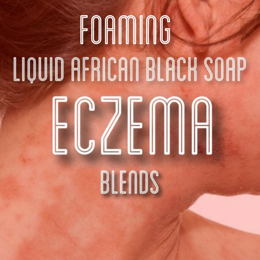 Fra Fra's Naturals | Premium Healing Eczema Foaming African Black Soap Face and Body Wash