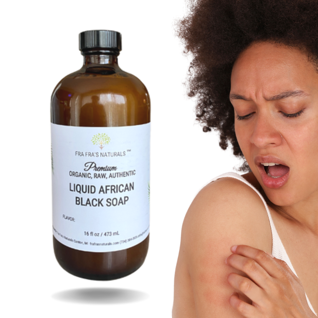 Fra Fra's Naturals | Premium Anti-Itch Liquid Black Soap Blend