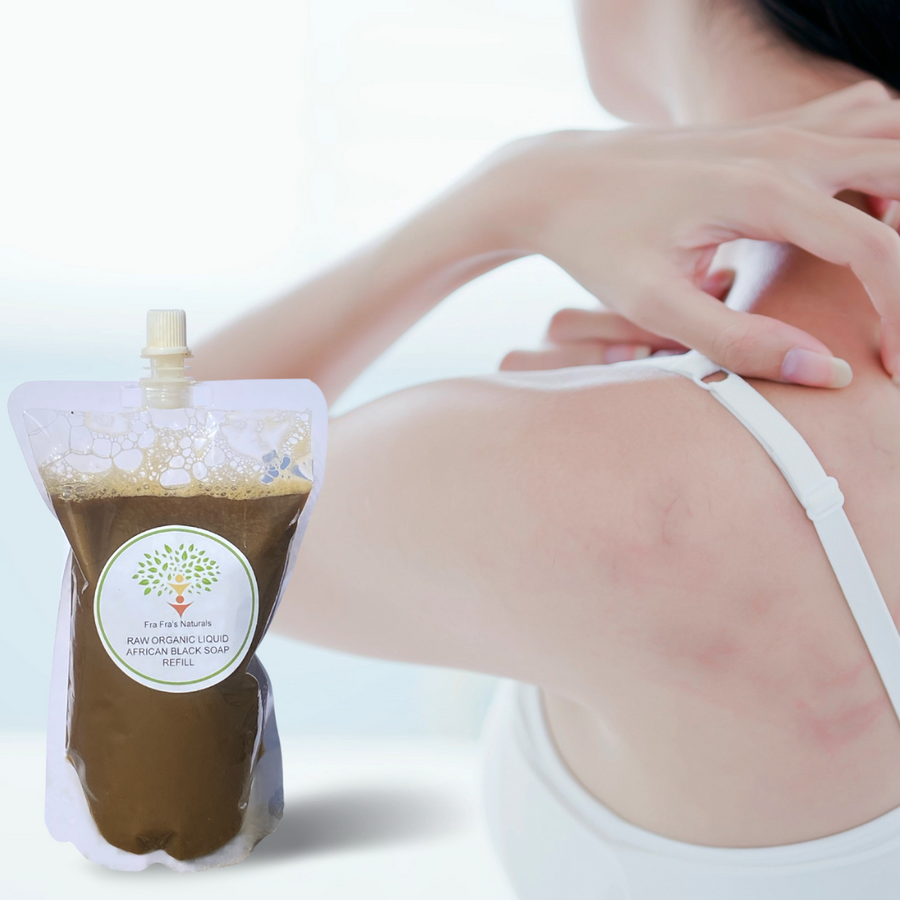 Fra Fra's Naturals | Premium Healing Eczema Blend Liquid Black Soap